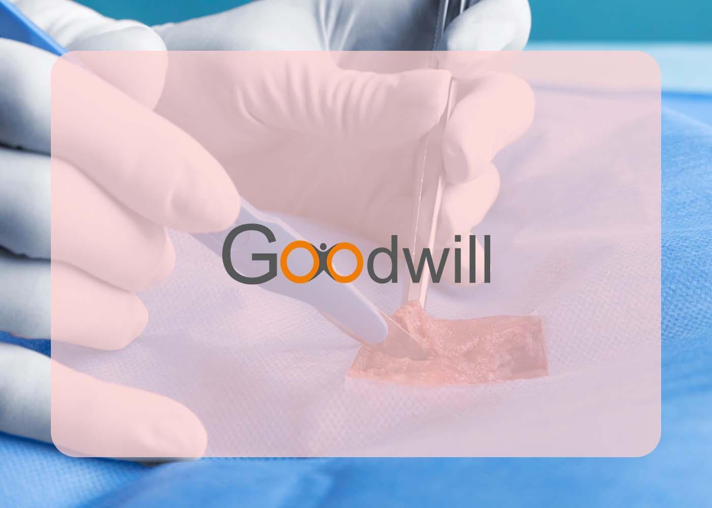 Why HEMOSPONGE Tampon Is a Game-Changer in Surgical Bleeding Control